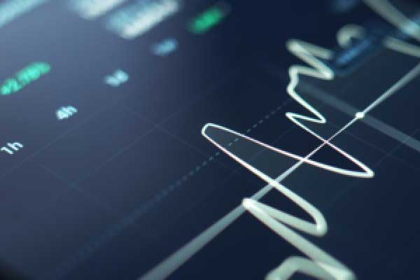 野村警告称：受美日政策压力影响 日元存在大幅升值的风险